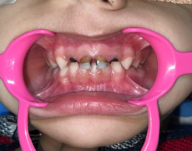 Pediatric transformation - Before 01